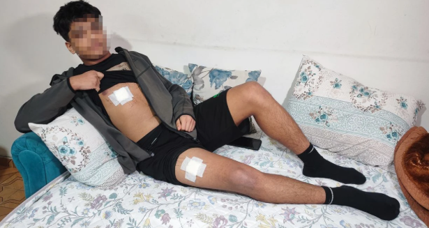 Seyhan’da Akran Zorbalığı Kanla Bitti